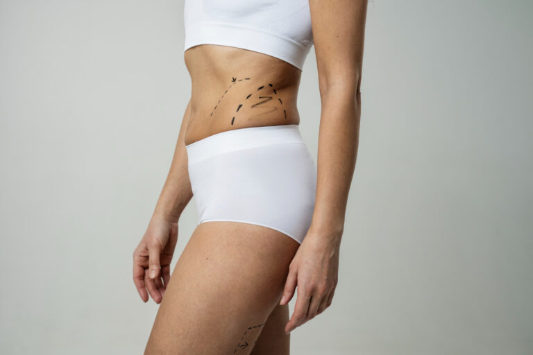 liposuction in dubai