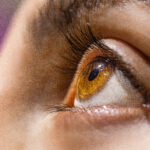 cataract meaning