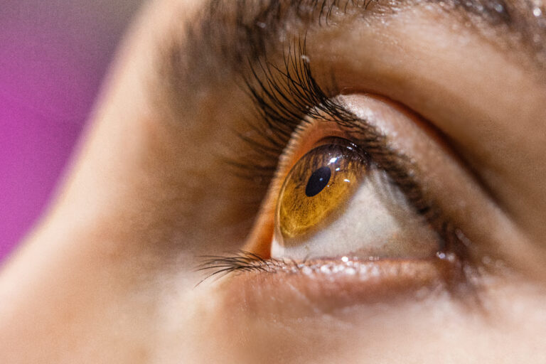 cataract meaning