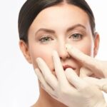 Septoplasty in Dubai